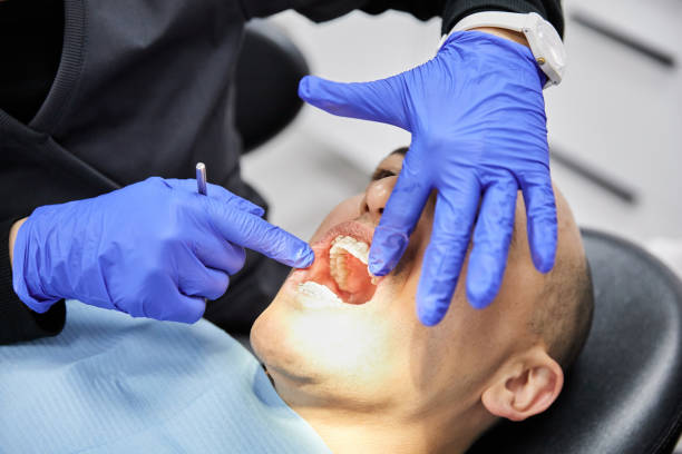 Best Emergency Dentist for Knocked-Out Tooth in St Joseph, IL